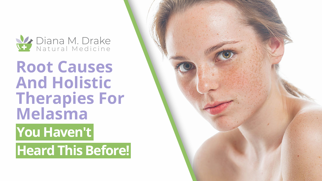 
Root Causes And Holistic Therapies For Melasma - You Haven't Heard This Before!